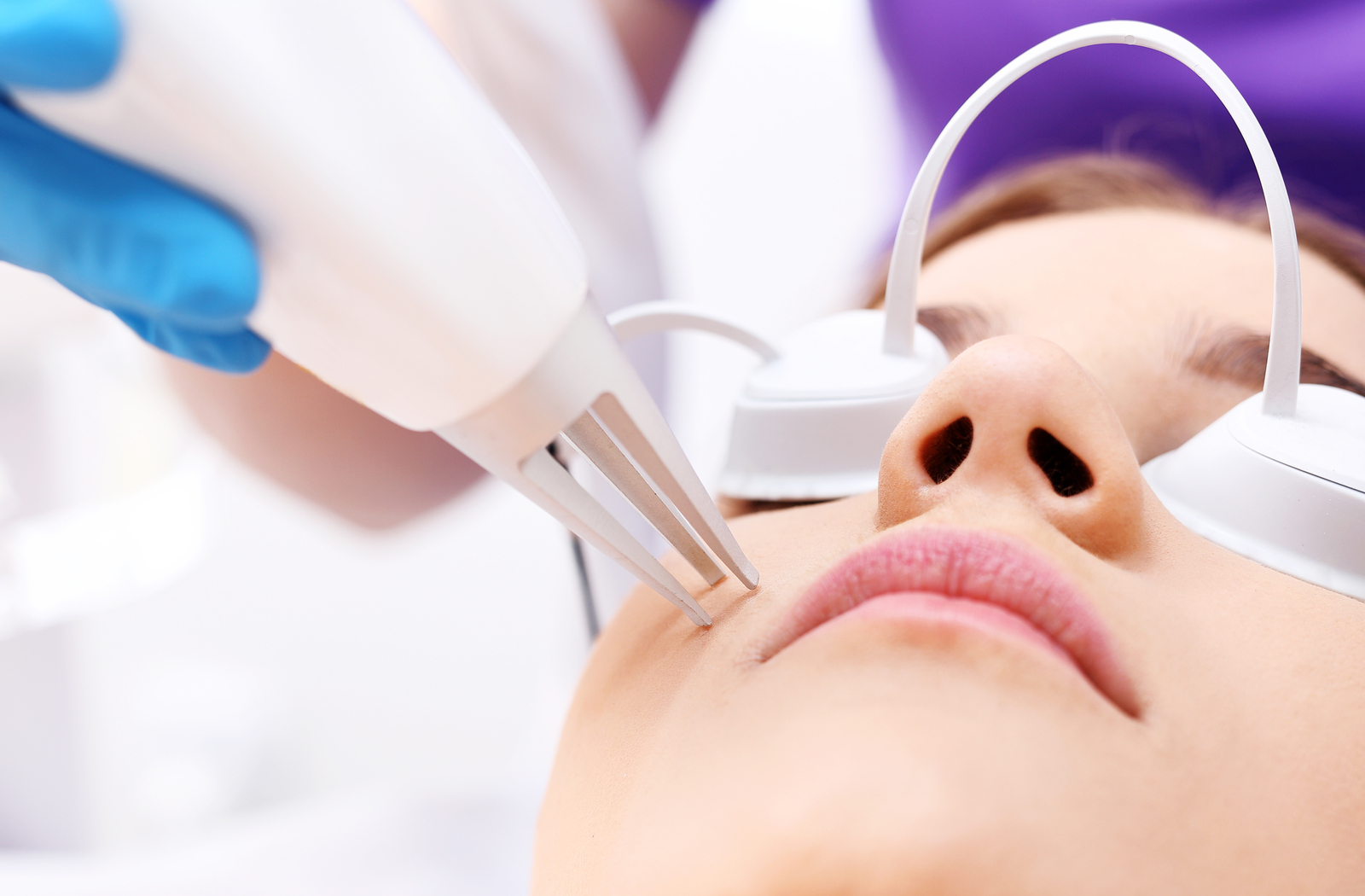 How Laser Treatment Can Help With Acne Scars
